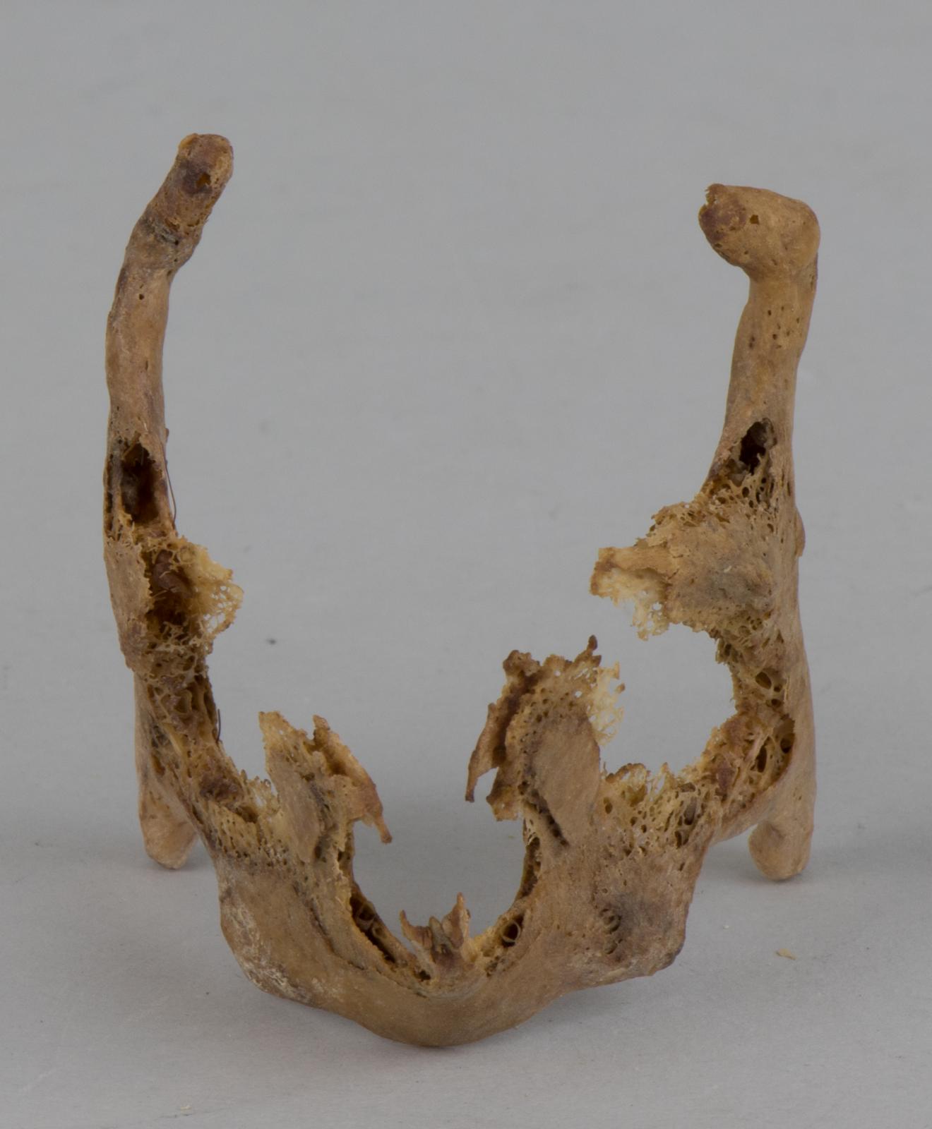 Cartílago tiroides 9