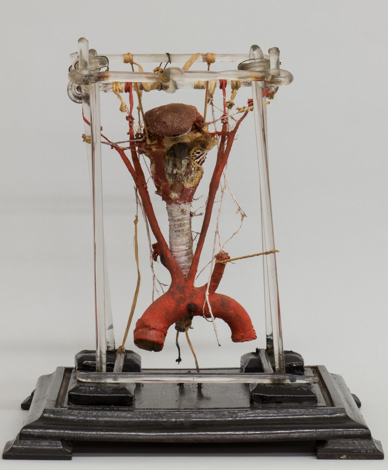 Nervios de la laringe sobre pieza natural